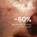 Siero antimacchia - 1% di bakuchiol - immagine 2
